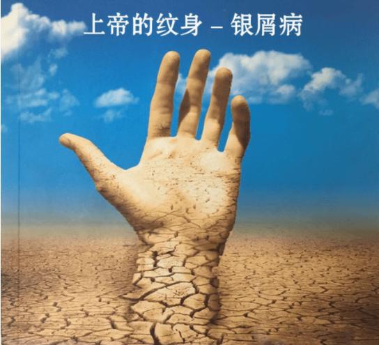 它被称为上帝的
